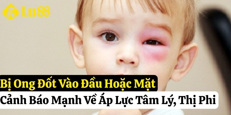 tự nhiên bị ong đốt đánh số gì