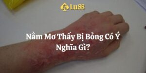 nằm mơ thấy bị bỏng lu88 thumb